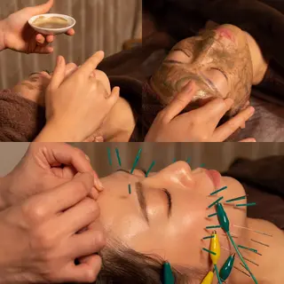 メンズ 即小顔♥️美容鍼× ハーブピーリングのその他イメージ