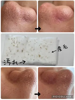 【リベルハーブピーリング認定店】敏感肌・美白脱毛専門店Dione立川店所属・Dione 立川店のエステ・リラクイメージ