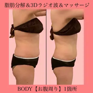 ✨美肌水光✨ アトリエリュバンのエステ・リラクイメージ