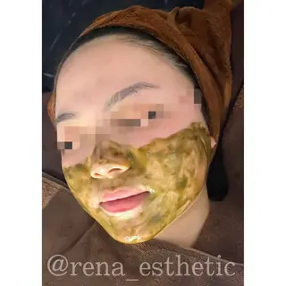 ハーブピーリング・毛穴ケア専門サロンSalon de LENA所属・ハーブピーリング 専門店/名古屋駅前店のエステ・リラクイメージ