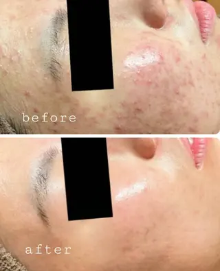 ECLAT所属・プライベートサロン✢ Eclatエクラ のエステ・リラクイメージ