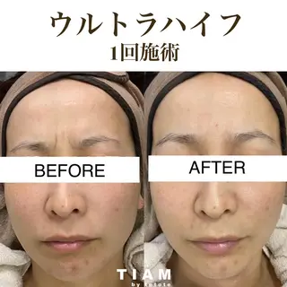 美肌サロンTIAM by tetoteのエステ・リラクイメージ