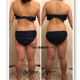 FLEUR大阪・美容 整体・痩身・小顔のエステ・リラクイメージ