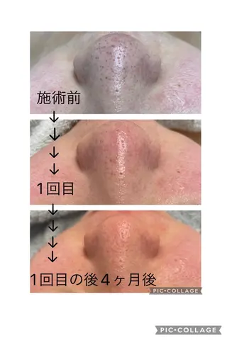 BeautySalonGemmy所属・Gemmy 愛美のエステ・リラクイメージ