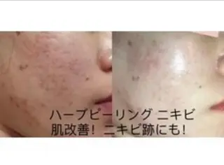 エステサロン ユミのエステ・リラクイメージ