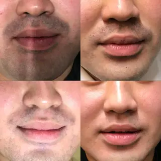 Lilyboo 池袋のエステ・リラクイメージ