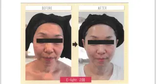 private salon meのエステ・リラクイメージ