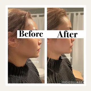 12Dハイフ💗 最強小顔のエステ・リラクイメージ