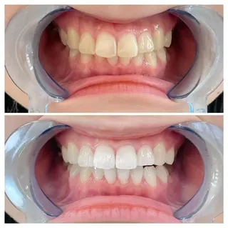 ロング ヘアアレンジ ネイル マツエク・マツパ メンズ カラー キッズ パーマ アイブロウ ライトビューティー 銀座店のエステ・リラクイメージ