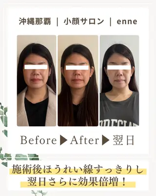 小顔サロンenne所属・小顔サロンenne 【エンネ】のその他イメージ