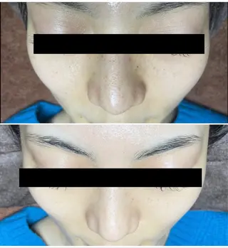 代表 MOMOの眉毛・アイブロウイメージ