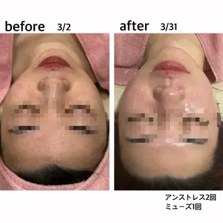 フェイシャル/脱毛 ジョアアンジェ竹田のエステ・リラクイメージ