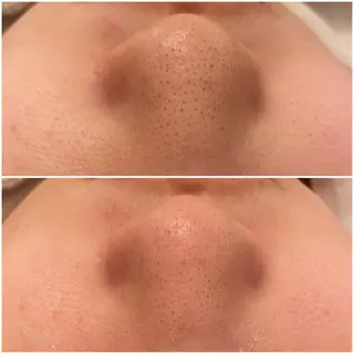 ✨美肌水光✨ アトリエリュバンのエステ・リラクイメージ