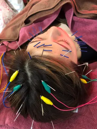 美容鍼灸女性専用 りんご鍼灸治療院のその他イメージ