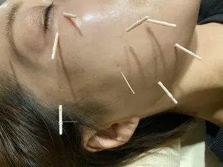 むくみたるみ専門☆ 美容鍼・小顔矯正のエステ・リラクイメージ