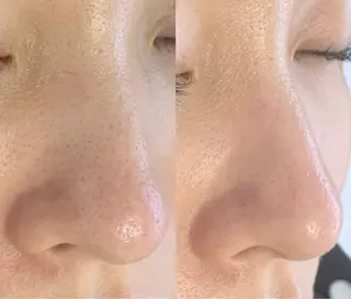 メンズ salonLADYSTYLE所属・稲嶺 美華のエステ・リラクイメージ