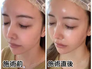 BestBelleꕤ 大阪福島/肌質改善のエステ・リラクイメージ