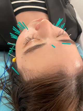 小顔美容鍼専門サロン 渋谷YZのエステ・リラクイメージ