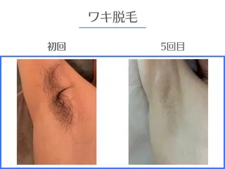 セルフホワイトニング エクシア岡崎店所属・ホワイトニング/脱毛 専門店エクシア岡崎店のその他イメージ