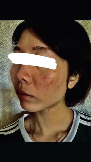 メナードフェイシャルエステサロン伊勢崎宮子店所属・メナード伊勢崎宮子店 矢内のその他イメージ