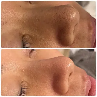 yellow.所属・yellow💛【 脱毛&フェイシャル】のエステ・リラクイメージ