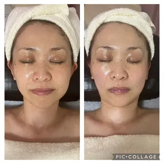 メディカルエステ　痩身·小顔専門サロンBBC 田園調布所属・KEI KOのエステ・リラクイメージ