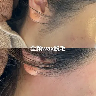 EST BEAUTY所属・顔専門ワックス脱毛/ ハーブピーリングのエステ・リラクイメージ