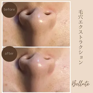ピーリング専門店 Belluteのエステ・リラクイメージ