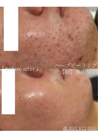 ニキビ改善専門店 d'Albaのエステ・リラクイメージ