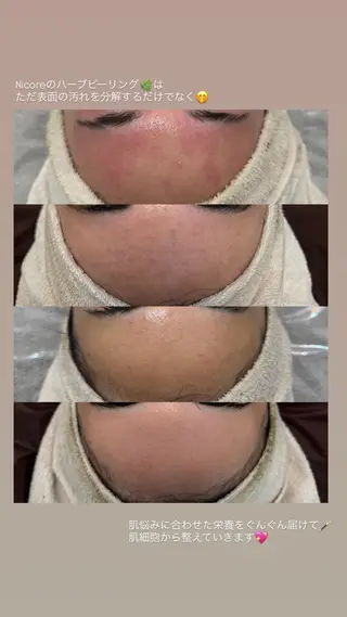 Nicore所属・肌質改善🌿まつ毛 chapiのエステ・リラクイメージ