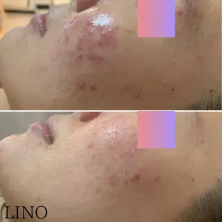 beautysalon  LINO所属・平日限定！お得！ 全メニュ¥5,500のエステ・リラクイメージ