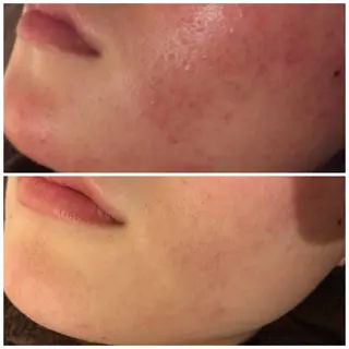 触れたくなる モテ肌へ...❤︎のエステ・リラクイメージ