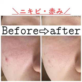 ショート カラー パーマ ヘアアレンジ メンズ キッズ ネイル マツエク・マツパ ニキビ&跡改善サロン オーナー光木のエステ・リラクイメージ