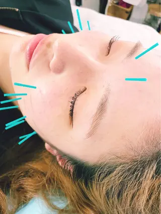 小顔美容鍼専門サロン 渋谷YZのエステ・リラクイメージ