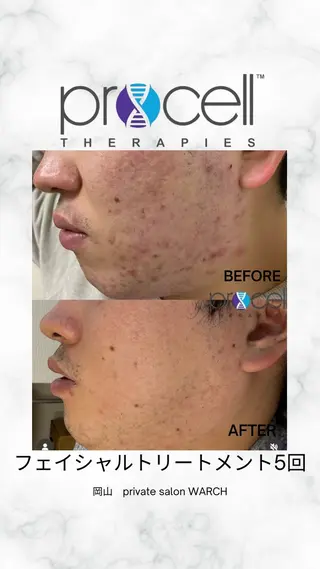 WARCH Marieのその他イメージ