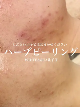 WHITE AQUA 北千住店のエステ・リラクイメージ