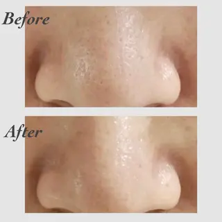 小顔・ツルツル素肌 ハリステリアのエステ・リラクイメージ