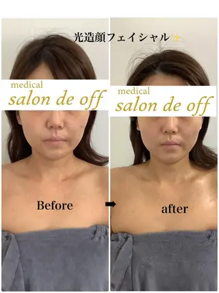 🩵Tatsumi Kana🩵のエステ・リラクイメージ