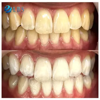 LBSホワイトニング 銀座店💎スタッフ峯のその他イメージ