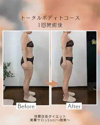 【痩身▪️体質改善ダイエット】美養サロンEnbi～縁美～所属・美養サロンEnbi ～縁美～のエステ・リラクイメージ