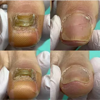 サンキューフット浦和店所属・サンキューフット 浦和店のエステ・リラクイメージ