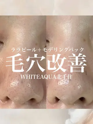 WHITE AQUA 北千住店のエステ・リラクイメージ