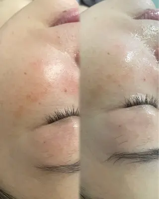 天神 MeMeのエステ・リラクイメージ