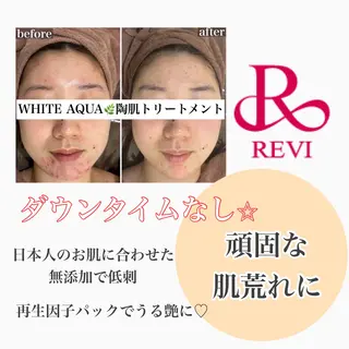 White Aqua 福岡博多店のエステ・リラクイメージ