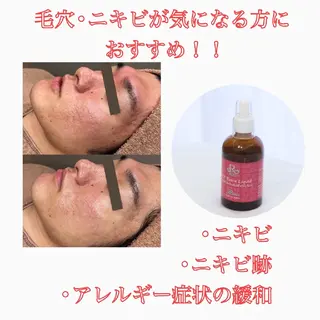 WhiteAqua 博多店　Erikoのエステ・リラクイメージ