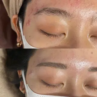 アイブロウ メンズ Epina 千葉店 【エピナ】のエステ・リラクイメージ