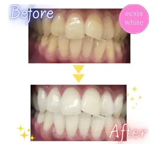 ecxia  white 　広島袋町店所属・セルフホワイトニング エクシア広島袋町店のその他イメージ