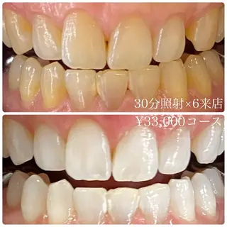 PLATINUM Beauty 横浜店所属・ホワイトニングルーム 横浜店のその他イメージ