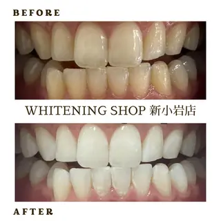 メンズ ホワイトニング ショップ新小岩店のその他イメージ