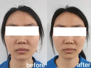 Beauty Zion所属・Beauty Zionのエステ・リラクイメージ